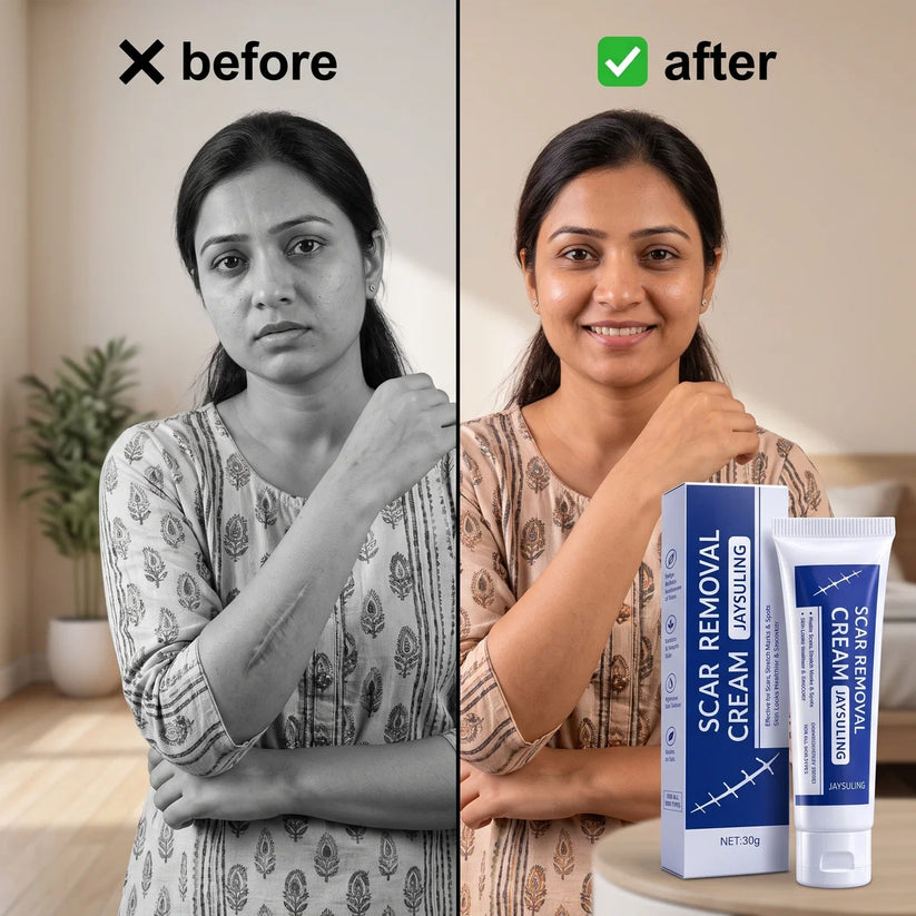 Scar Removal Cream | Keloid & Stretch Mark Care | Softening & Flattening