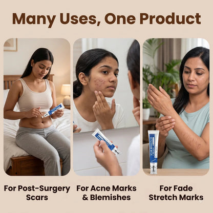 Scar Removal Cream | Keloid & Stretch Mark Care | Softening & Flattening